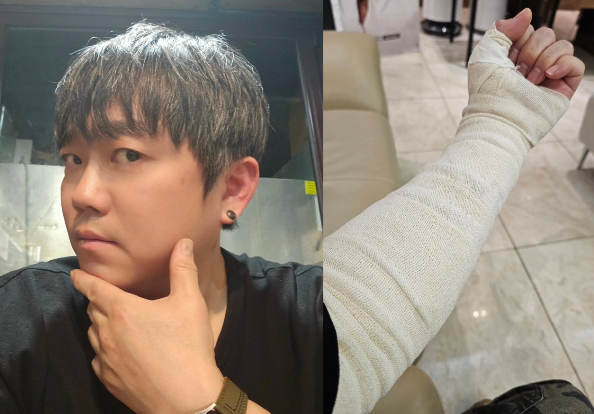 그룹 원타임 출신 송백경이 문신 제거를 시작한 근황을 밝혔다. /사진=송백경 인스타그램