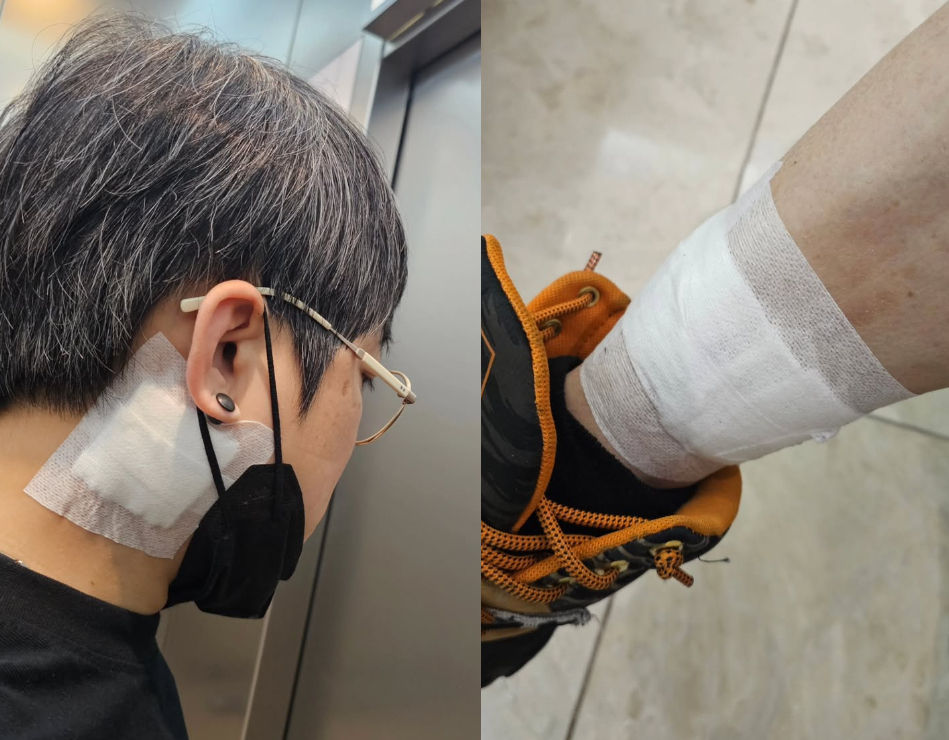 그룹 원타임 출신 송백경이 문신 제거를 시작한 근황을 밝혔다. /사진=송백경 인스타그램