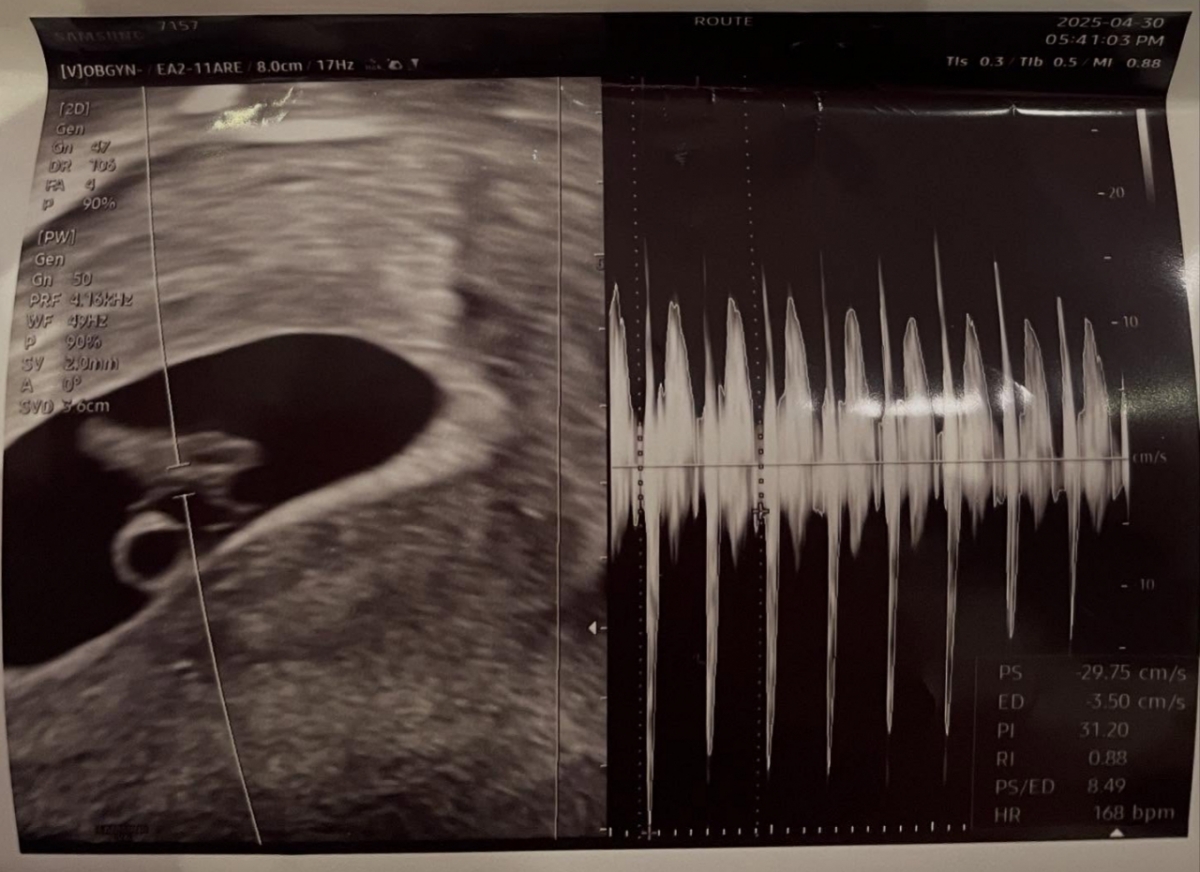 서은우가 혼전 임신 소식을 전하며 공개한 태아 초음파 사진. /사진=인스타그램 갈무리