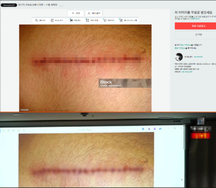 김세의 대표가 기자회견에서 공개한 A씨의 목, 손 사진은 이미지 판매 사이트에서 도용한 것으로 확인됐다. /사진=유튜브 채널 가로세로연구소,  iStock 캡처