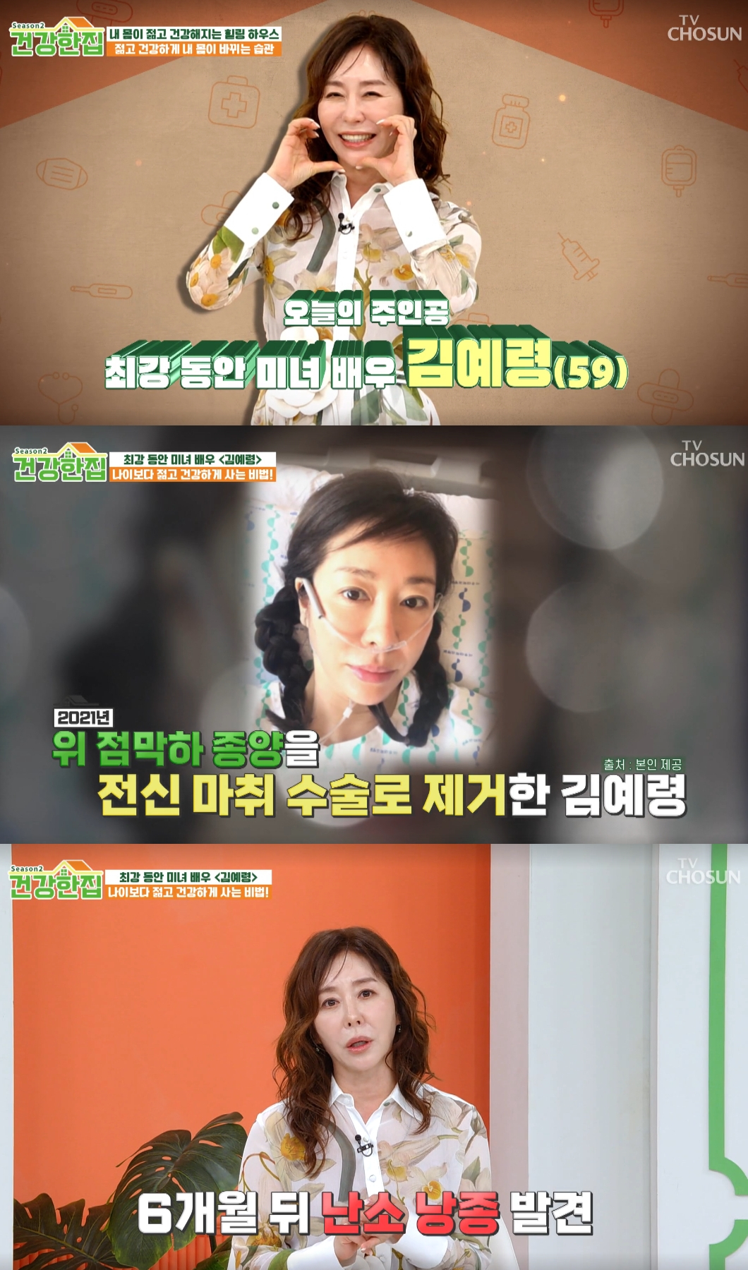 배우 김예령이 세 차례나 전신 마취 수술을 진행했다고 밝혔다. /사진=TV조선 '건강한집' 시즌2 방송화면