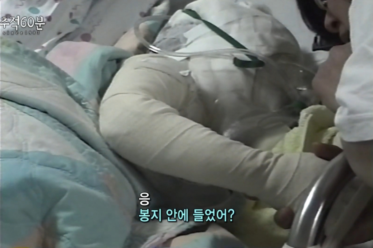 1999년 5월20일 대구 한 골목길에서 발생한 '황산 테러 사건'으로 세상을 떠난 김태완군이 생전 병상에서 엄마에게 사건 당일에 대해 증언하는 모습./사진=KBS '추적 60분' 방송 화면 캡처