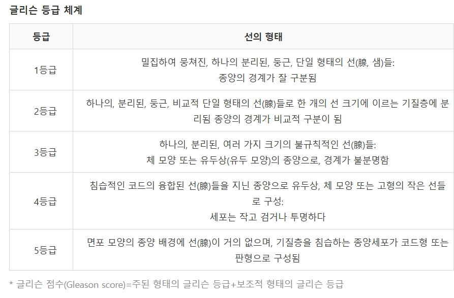 전립선암의 악성도를 가리는 글리슨 등급 기준표.  /자료=국가암정보센터