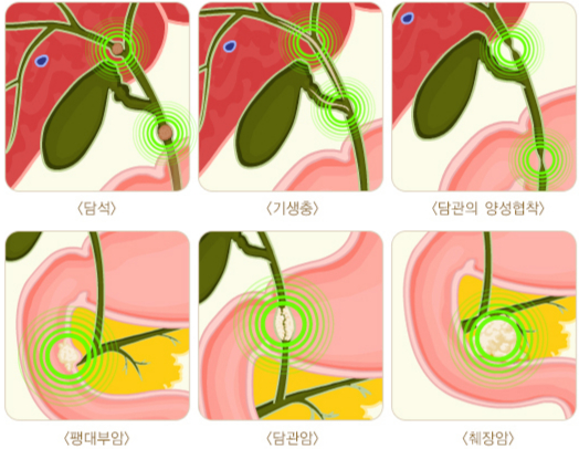 담과이 막히는 여러 원인. /자료=국가건강정보포털