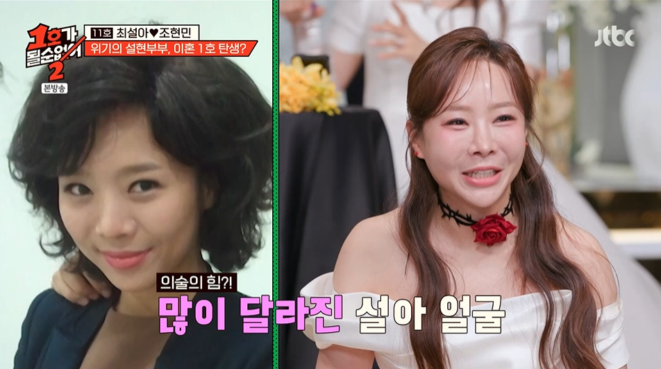 '코미디언 부부 11호' 최설아와 조현민이 성형 중독 문제로 갈등을 빚었다. /사진=JTBC '1호가 될 순 없어 2' 방송 화면