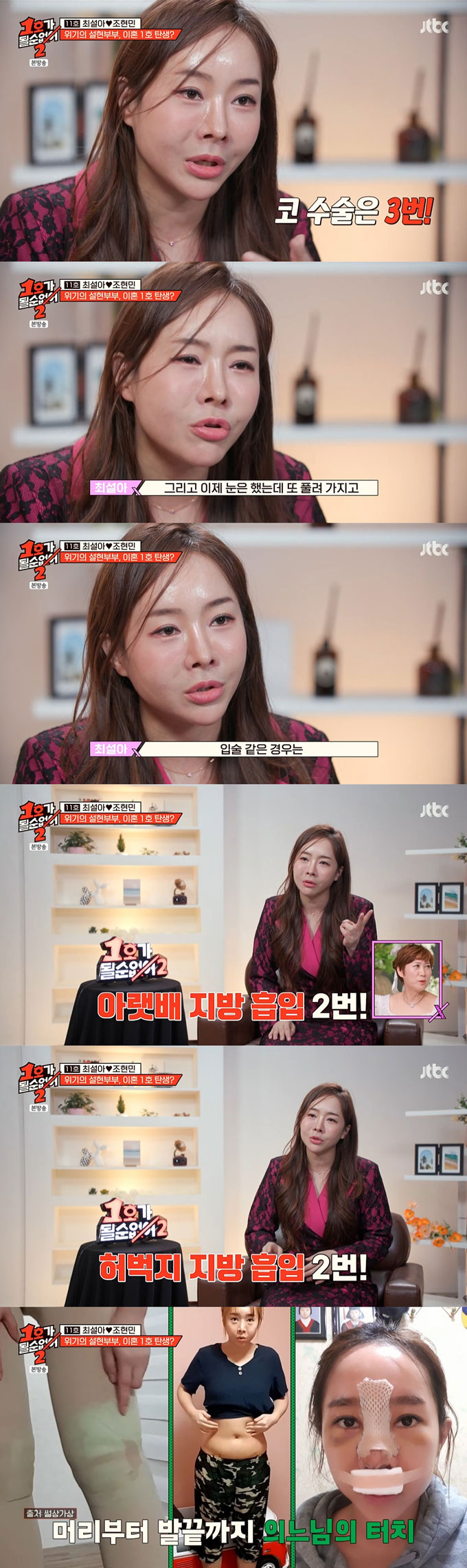 코미디언 최설아가 눈, 코, 입술, 지방흡입 등 수많은 성형수술을 받았다고 고백했다. /사진=JTBC '1호가 될 순 없어2' 방송 화면