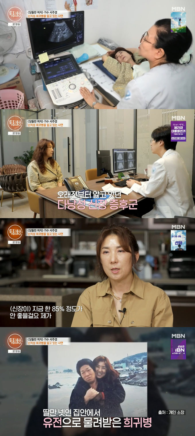 가수 서주경이 30년간 유전 희귀 질환인 다낭성 신장 증후군을 앓아왔다고 고백했다. /사진=MBN '특종세상' 방송화면 