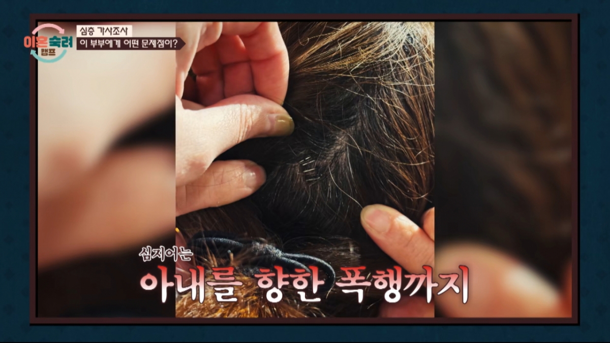 남편이 아내의 뒷통수를 가격했다. /사진=JTBC '이혼숙려캠프' 캡처