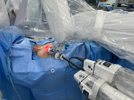 GOSTA 수술로 갑상선암을 치료하는 모습.