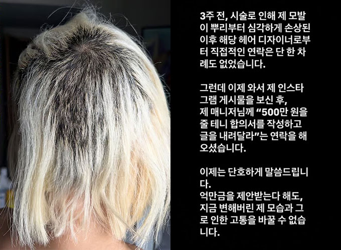 DJ소다가 탈색 시술 후 머리카락이 끊겨 삭발 머리처럼 됐다는 소식을 전하며 사진을 공개한 후, 미용실 측에서 '500만원을 줄테니 게시물을 내려달라'고 요구해왔다고 전했다. /사진=DJ 소다 인스타그램