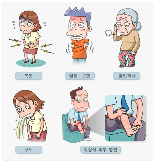 비브리오 패혈증의 증상. /자료=질병관리청 국가건강정보포털