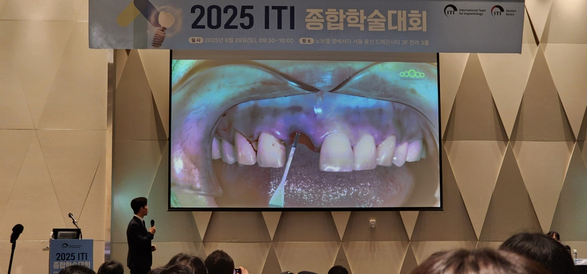 국제임플란트학회 한국지부(ITI Section Korea)가 주최한 이번 학술대회는 국내 유수의 치과 임상가들이 연자로 나서 임플란트 진료의 최신 지견과 실제 임상 적용 전략을 공유했다. /사진=정심교 기자