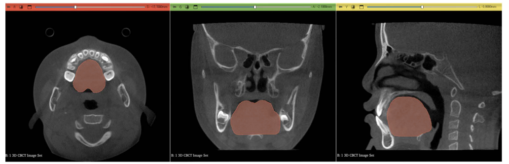 /사진=플로스원,고려대안암병원
