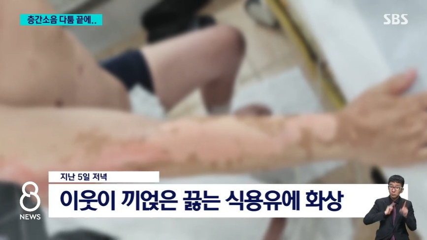 대전에서 60대 남성이 층간소음 때문에 찾아온 이웃에게 끓는 식용유를 끼얹어 3도 화상을 입히는 사건이 발생한 가운데, 피해자 측이 화상 사진을 공개하며 엄벌을 촉구했다. /사진='SBS 8 뉴스' 캡처 