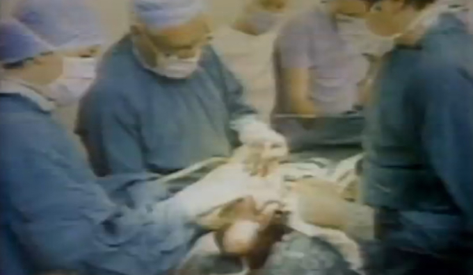 1978년 7월 25일 영국 올덤 종합병원에서 세계 최초의 '시험관 아기' 루이스 브라운이 태어났다. 출산은 비공개로 진행된 가운데, 사전 촬영된 일부 영상만 언론에 공개됐다. 불임 여성이 시험관 시술을 통해 임신해 출산한 것임을 입증하기 위해 제왕절개 수술 장면과 산모의 나팔관 이상을 보여주는 장면이 담겼다. /사진=MBC 뉴스 방송 화면