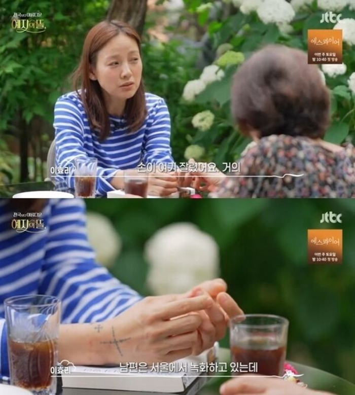 가수 이효리가 개 물림 사고로 수술을 받은 사연을 털어놨다. /사진=JTBC '천국보다 아름다운 혜자의 뜰'