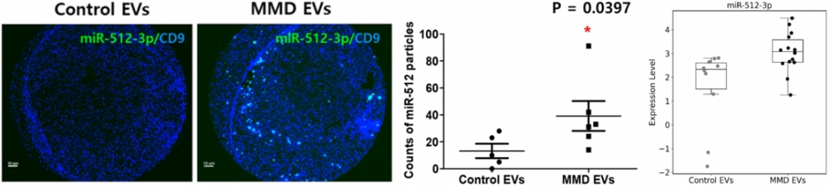 모야모야병 환자(MMD)와 정상 대조군(Control)의 혈장에서 분리한 세포외소포 내 miRNA를 분석한 결과. 환자군에서 miR-512-3p의 발현(Expression Level)이 유의미하게 높은 것으로 나타났다. /그림=서울대병원