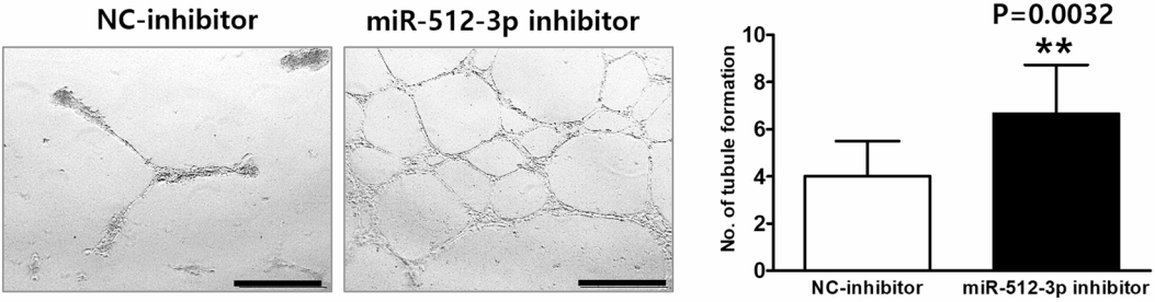  miR-512-3p 억제제 처리 후 모야모야병 환자 세포에서 혈관 형성 능력이 유의미하게 향상됐다. NC-inhibitor 처리군과 비교해 miR-512-3p 억제제 처리군에서 혈관 형성 능력이 향상된 결과가 나타났다. /그림=서울대병원