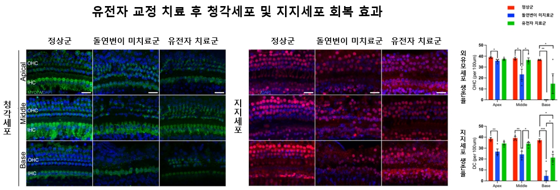 유전자 교정 치료 후 청각세포 및 지지세포 회복 효과: (왼쪽) 정상군 대비 유전자 치료군에서 외유모세포(OHC) 보존이 뚜렷하게 확인됐다. (가운데) 지지세포(DC)의 조직 구조도 치료군에서 회복 양상 나타남 (오른쪽) 치료군은 미치료군보다 OHC·DC 생존율이 유의미하게 높아, 조직 수준의 회복 효과를 입증함. /자료=서울대병원