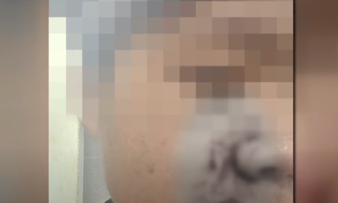 집단 폭행당하는 남학생을 돕다가 전치 2주 부상을 입고 아동학대 혐의로 고소까지 당했다는 사연이 전해졌다./사진=JTBC '사건반장'