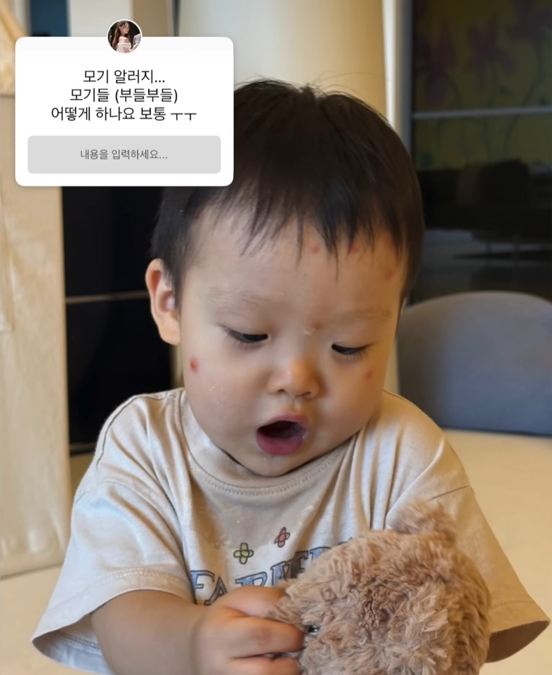 손연재 아들이 모기 알레르기인 '스키터 증후군'을 앓는 사실이 알려졌다. /사진=유튜브 갈무리