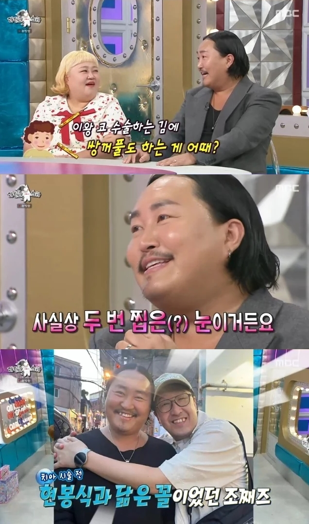 가수 조째즈가 성형수술을 받은 사실을 고백했다. /사진=MBC '라디오스타' 방송화면