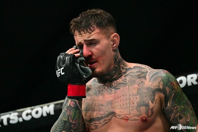 톰 아스피날이 오른쪽 눈을 감고 고통스러워하고 있다. /AFPBBNews=뉴스1