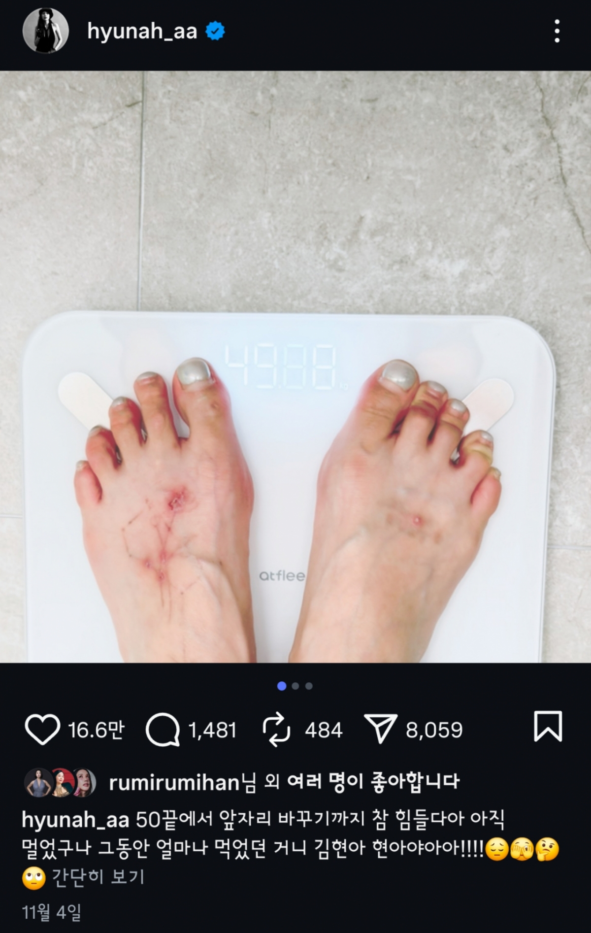 현아는 지난 4일 SNS에 49㎏가 된 자신의 체중 인증샷을 찍어 올렸다. 한 달 만에 10㎏가량 뺀 건데 무리한 다이어트는 미주신경성 실신을 위험을 높일 수 있어 주의해야 한다. /사진=현아 인스타그램