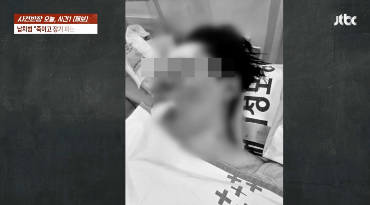 지난달 26일 밤 인천 송도국제도시에서 폭행 후 납치 당했던 구독자 100만 명의 게임 유튜버 수탉(31·본명 고진호)이 근황을 전했다./사진=JTBC '사건반장' 방송 화면