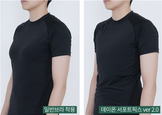 데이온 압박브라 사용 전후 사진./사진제공=나인나인디자인랩 