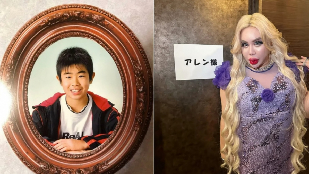 어린 시절 집단 괴롭힘 피해를 봤던 일본의 한 남성이 1억엔(약 9억5000만원)을 들여 전신 성형한 뒤 인플루언서로 성공했다. /사진=홍콩 사우스차이나모닝포스트(SCMP) 캡처