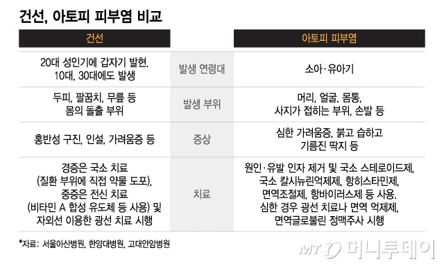 건선, 아토피 피부염 비교. /그래픽=이지혜 디자인기자