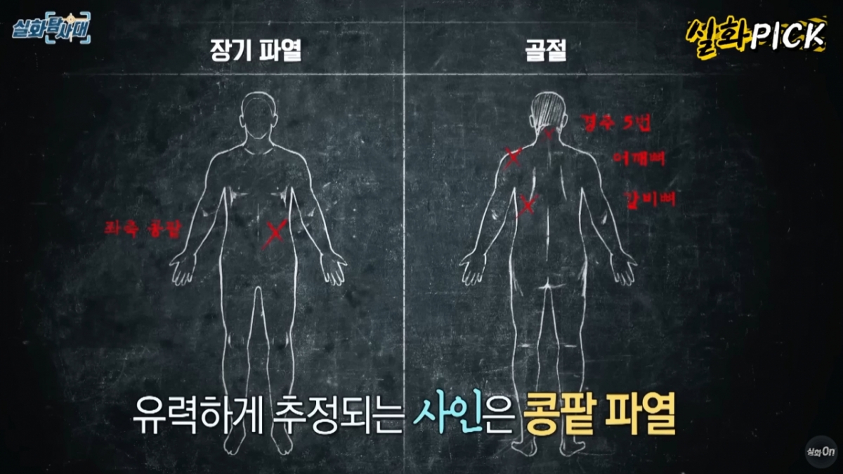  김 일병은 추락으로 5번 경추와 어깨뼈가 골절되고 왼쪽 콩팥이 파열됐다. 갈비뼈 골절은 심폐소생술 흔적. /사진=MBC 유튜브 채널 '실화 On' 갈무리 