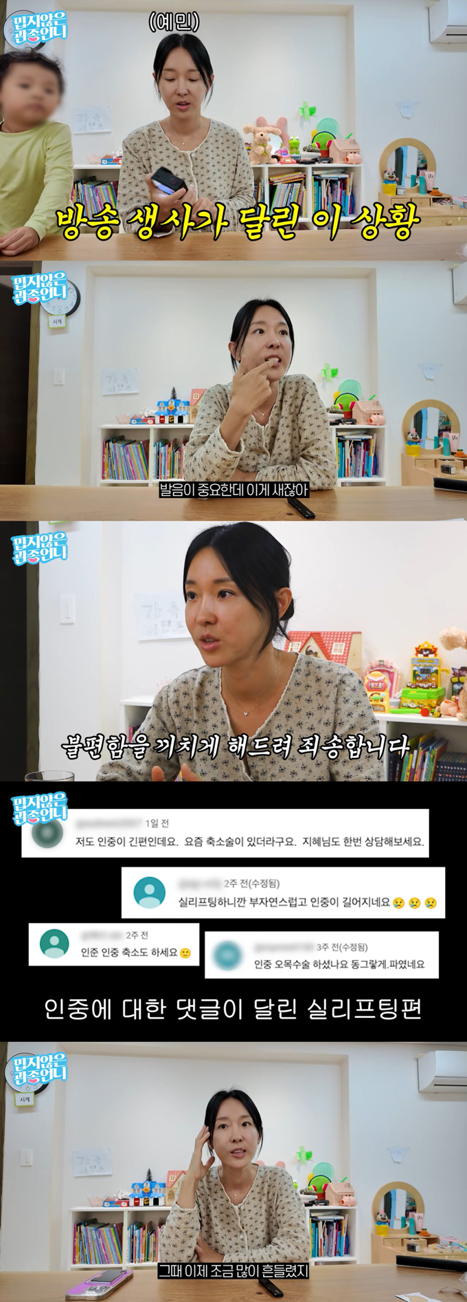 가수 이지혜가 인중축소술을 받은 뒤 발음이 새고 이미지가 달라졌다며 속상한 마음을 털어놨다. /사진=유튜브 채널 '밉지않은 관종언니' 영상