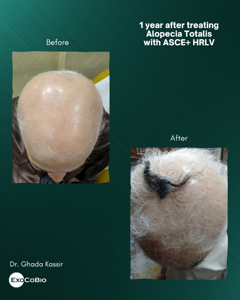  Ǹ ڹ̿ ASCE÷ ȭǰ ٸ  Ÿ ȿ/= ڹ̿