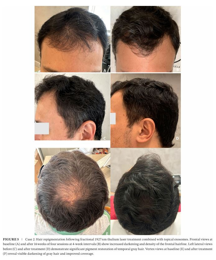  Ǹ ڹ̿ ASCE÷ ȭǰ ٸ  Ÿ ȿ/= ڹ̿