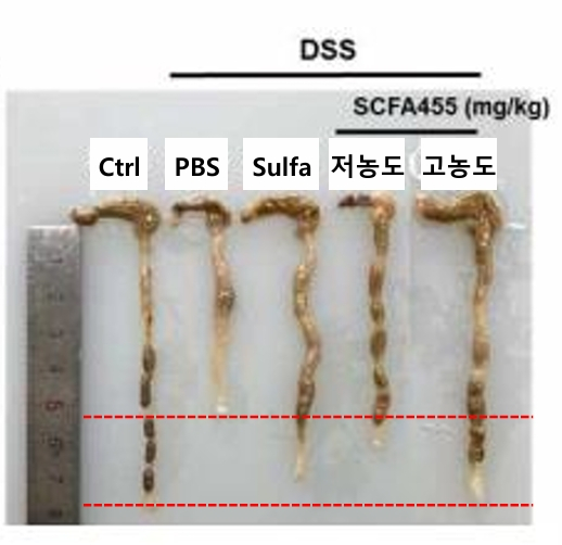 DSS(Dextran Sodium Sulfate)라는 황산기를 가진 다당류 유도체로 궤양성 대장염을 유도한 쥐 실험 결과. 궤양성 대장염에 걸린 쥐는 장이 손상당해 결장 길이가 짧아졌지만, 궤양성 대장염에 고농도의 단쇄지방산을 투여한 쥐는 결장 길이가 정상 수준에 가깝게 길이를 유지했다. /자료=엔피케이 