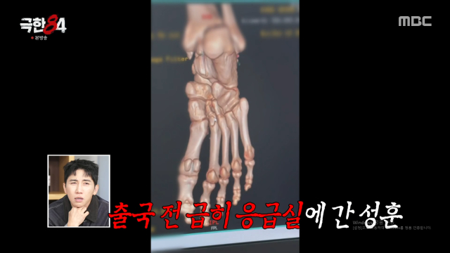 추성훈이 제트스키를 타다 발가락이 골절돼 마라톤 예능에서 하차했다. /사진=MBC '극한84' 방송화면 갈무리 