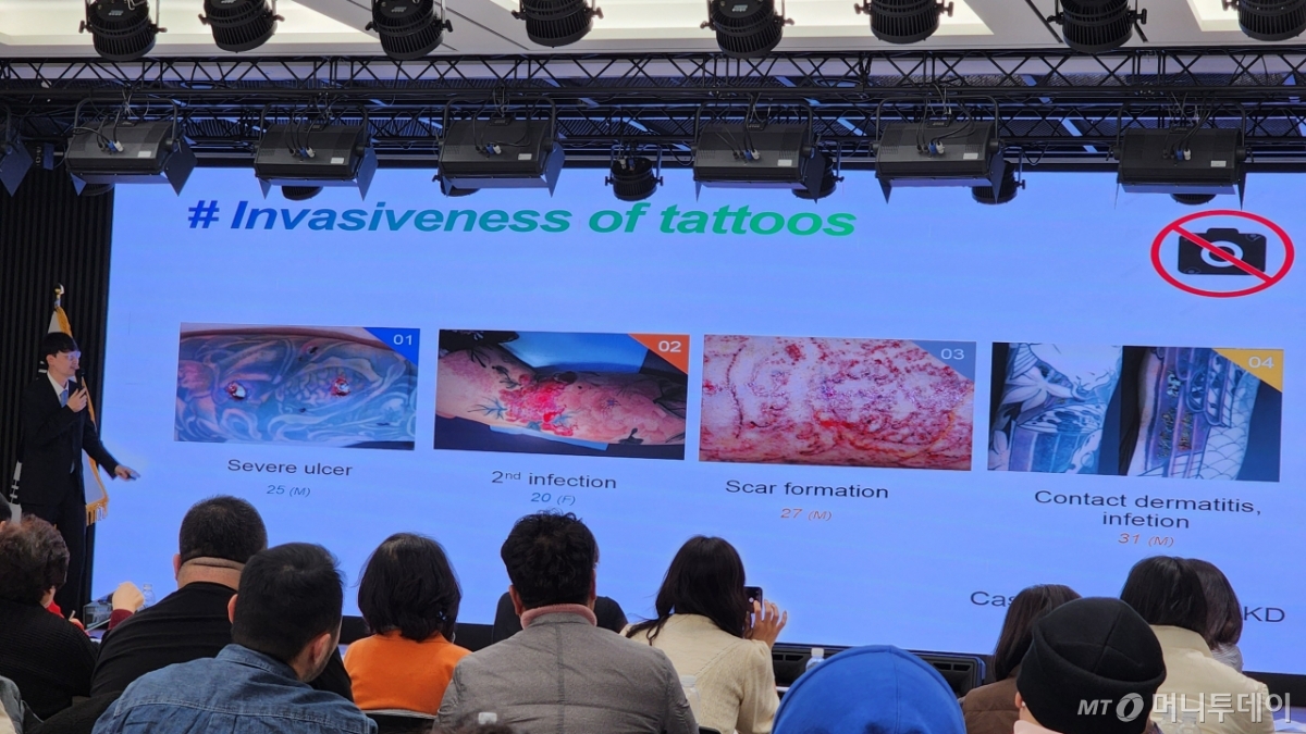 피부과 전문의인 김재홍 대한피부과의사회 기획정책이사(의협 '비의료인의 문신시술 법제화 대응' TF 위원)가 문신시술 후 피부 궤양, 감염, 흉터 형성, 피부염이 생긴 사례를 보여주며 문신시술 전 고객의 피부상태를 확인해야 하는 중요성을 설명하고 있다. /사진=정심교 기자