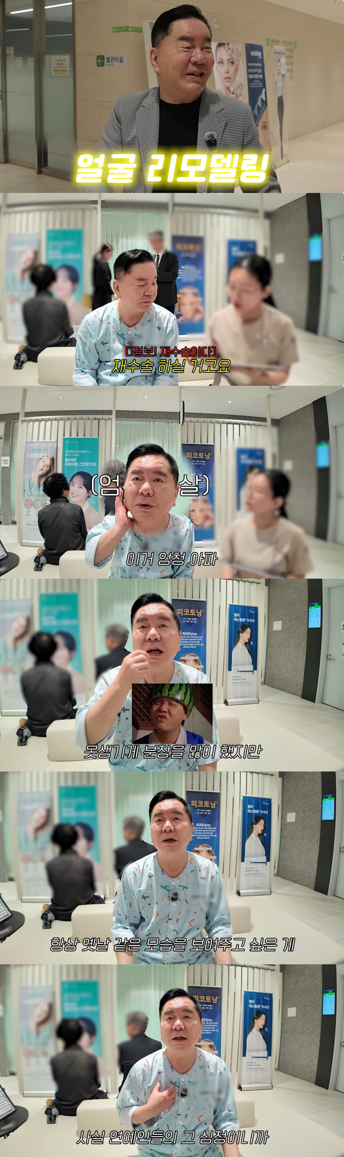 개그맨 겸 영화 감독 심형래가 안면거상 재수술을 받았다./사진=유튜브 채널 '영구TV' 영상