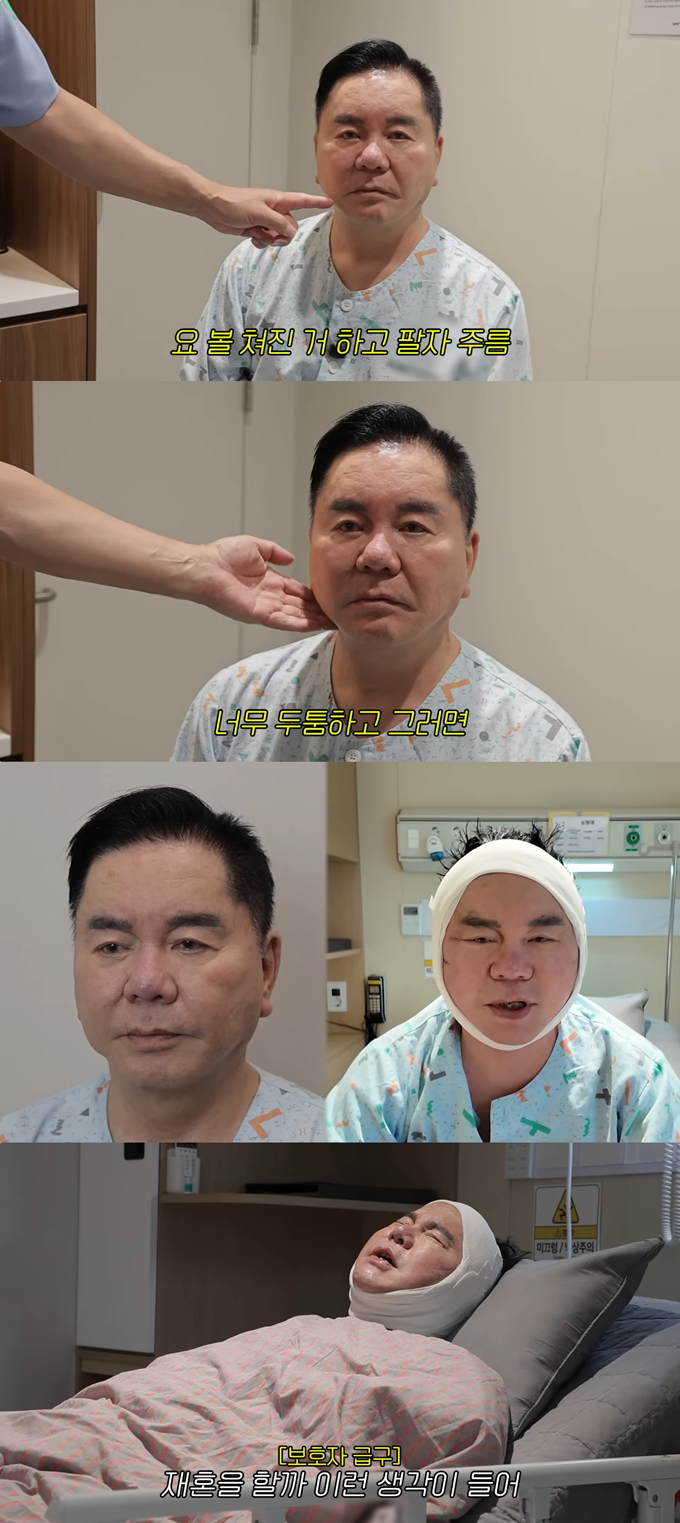 개그맨 겸 영화 감독 심형래가 안면거상 재수술을 받았다./사진=유튜브 채널 '영구TV' 영상