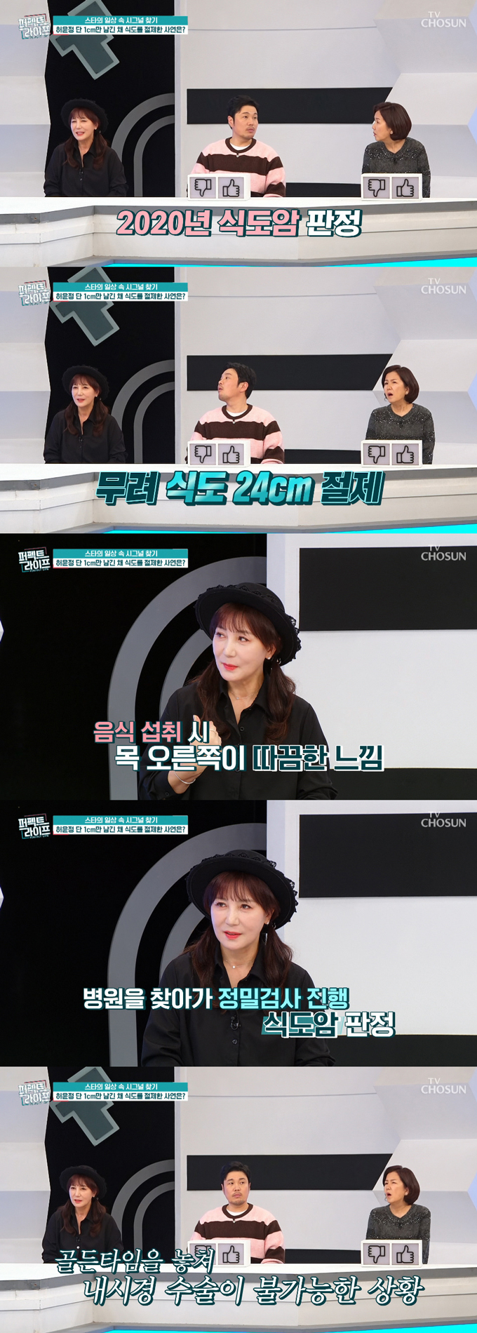 배우 허윤정이 과거 식도암 판정을 받고 수술을 받았다고 고백했다. /사진=TV조선 '퍼펙트라이프' 방송 화면