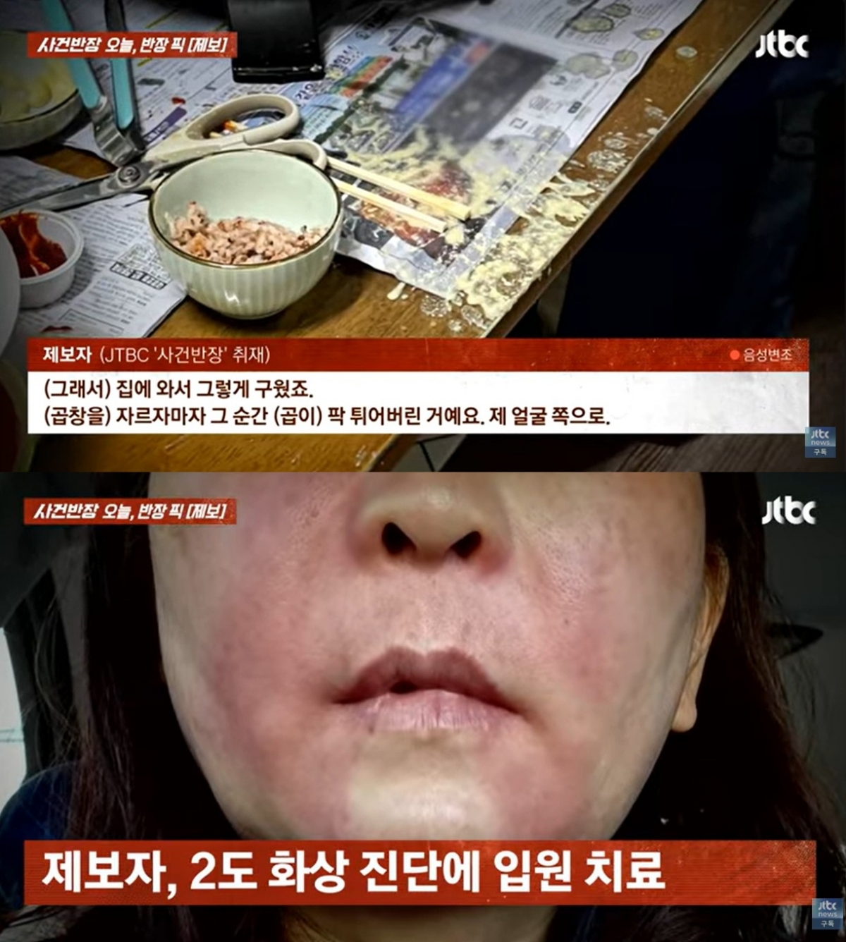 마트에서 구매한 곱창을 집에서 구웠더니 '펑'하고 터져 화상을 입었다는 사연이 전해졌다. /사진=JTBC '사건반장'