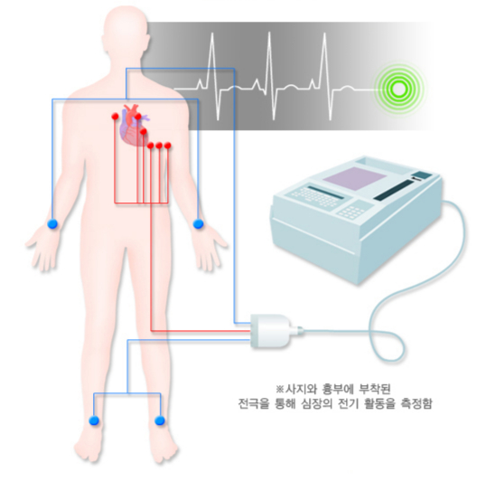심방세동을 진단하기 위한 심전도 검사법. /자료=국가건강정보포털