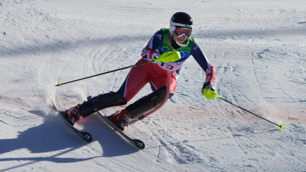 케미 알코트. /사진=더선 갈무리