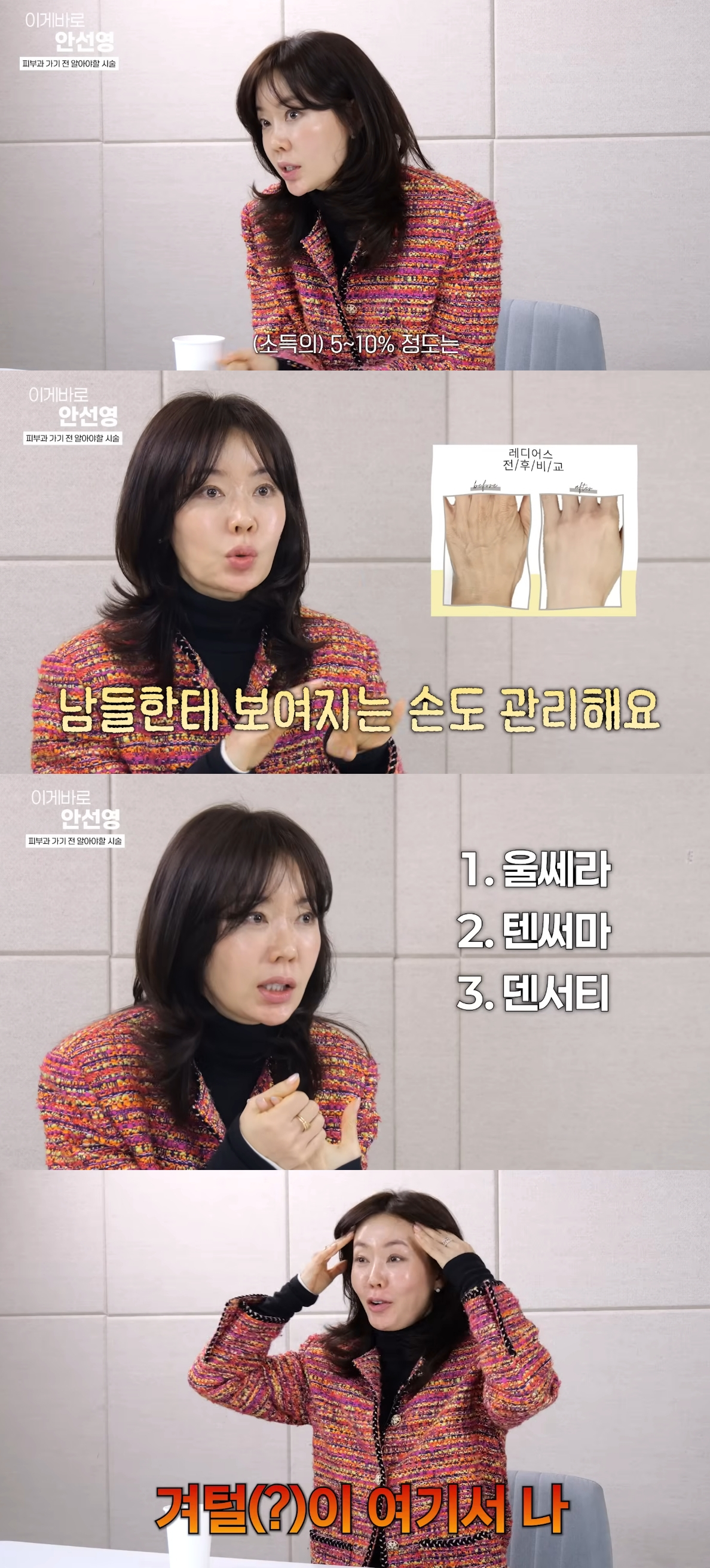 방송인 안선영이 결혼식 전 겪었던 충격적인 시술 부작용을 공개했다. /사진=유튜브 영상 갈무리