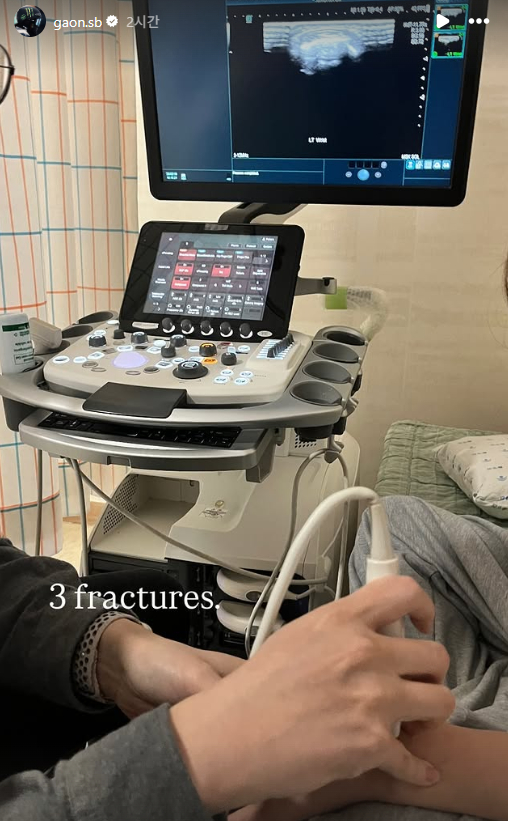 '2026 밀라노·코르티나담페초 동계올림픽'에서 한국에 첫 금메달을 안긴 최가온이 자신의 SNS에 골절을 암시하는 게시물을 올렸다. /사진=최가온 SNS 화면캡처.