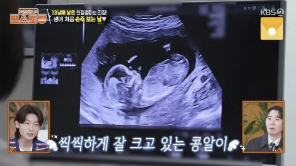 배우 남보라가 태아 기형아 검사를 마치고 안도했다. /사진=KBS2 '신상출시 편스토랑'