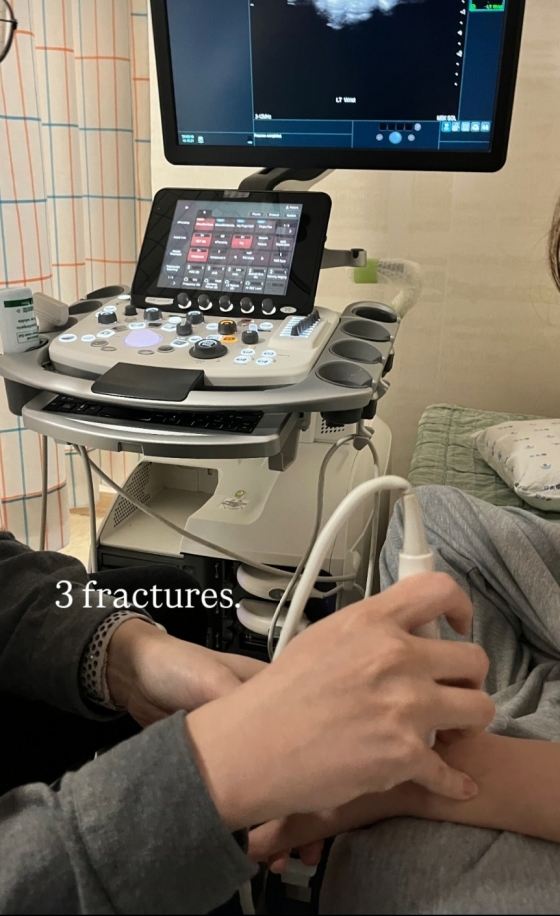 '3 fractures(세 군데 골절)'이라는 문구와 병원에서 검진받는 사진을 올린 최가온. /사진=최가온 개인 사회관계망서비스(SNS)