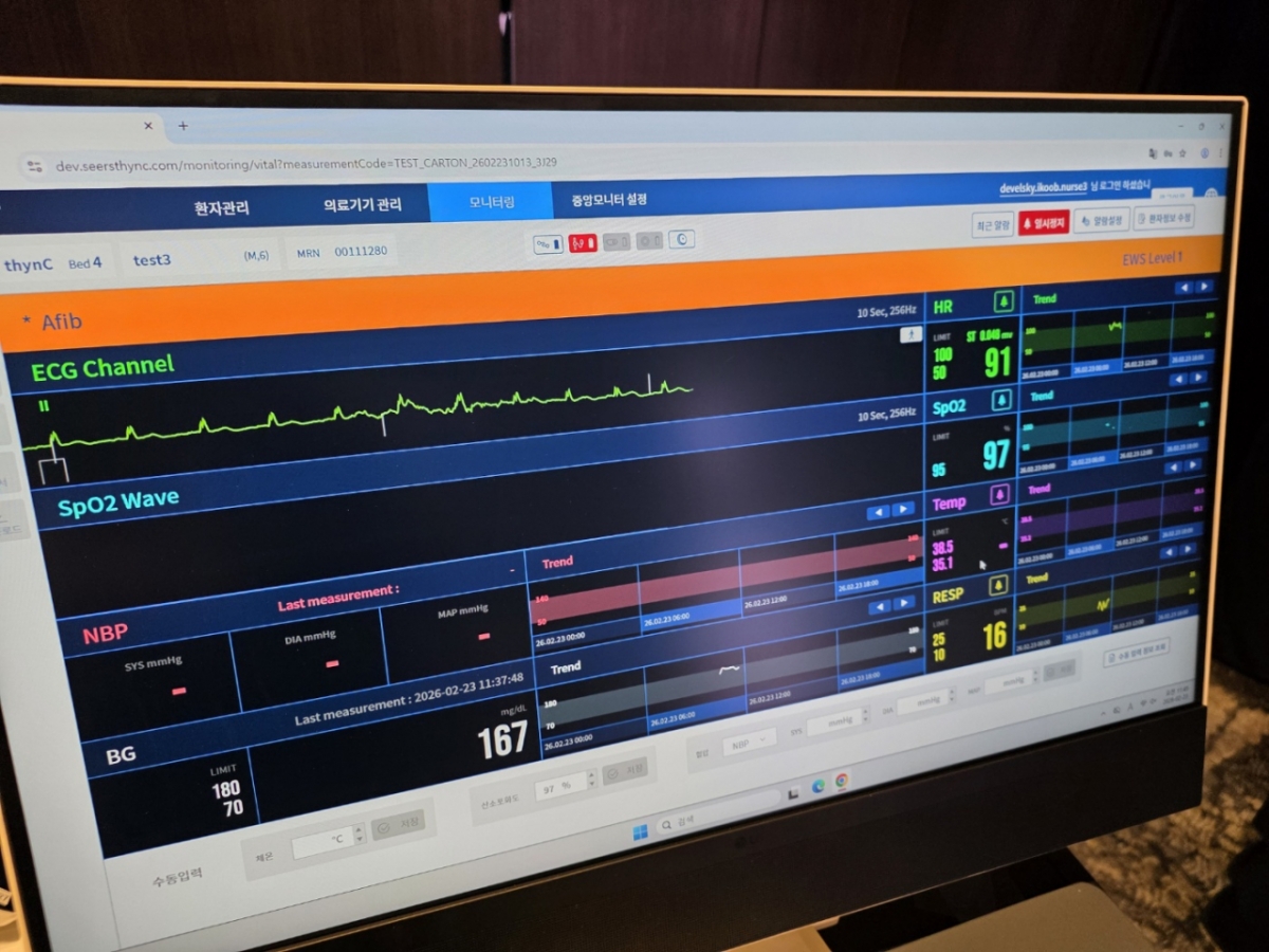 올뉴씽크 구동 화면. 위에서부터 심전도, 산소포화도(이상 씽크), 혈압(카트 온), 혈당(CGM LIVE) 등이 연속된 데이터로 한 눈에 들어온다./사진=박정렬 기자 